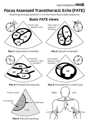 How to obtain the cardiac views - FATE Cards