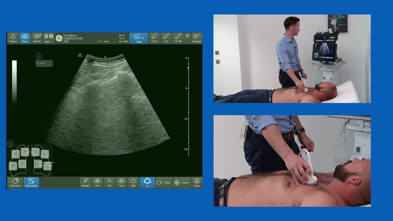 How to Perform Ultrasound of the Lungs