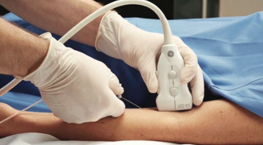 How To Use Ultrasound For Vascular Access