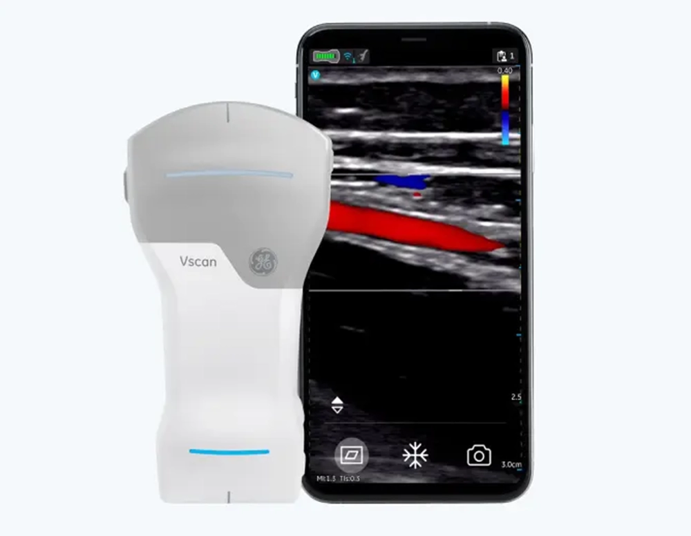 Vscan Air CL
