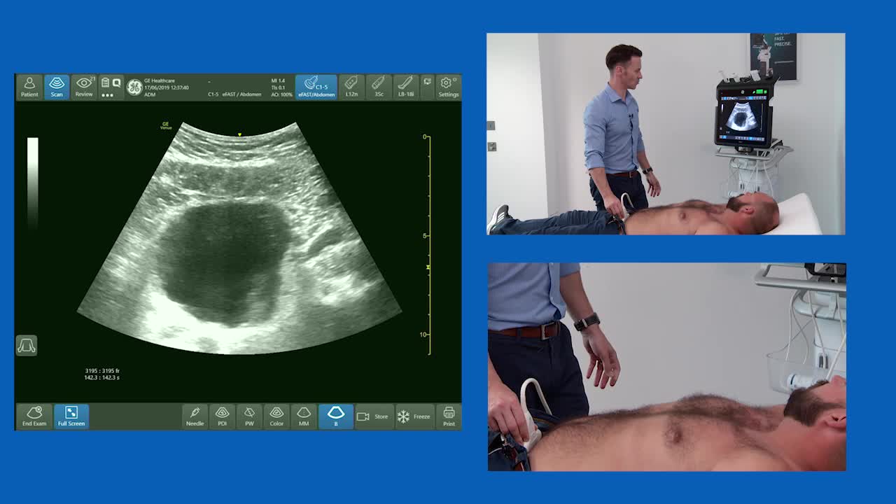 How To Ultrasound The Abdominal Aorta & Femoral Vein