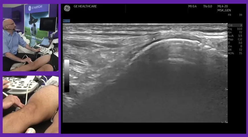 Masterclass on scanning the lower extremity for football related injuries