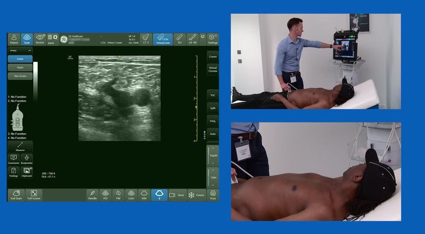 How To Determine Deep Vein Thrombosis through Ultrasound