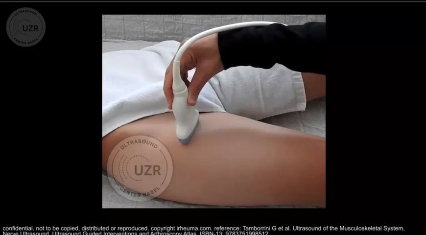 The use of ultrasound to assess the hip joint with selected pathologies.