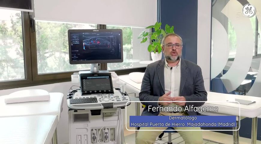 La ecografía en dermatología