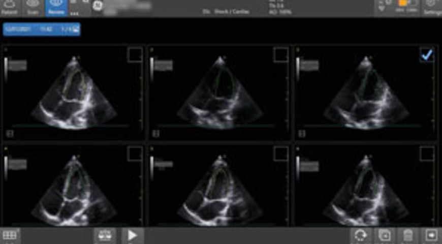 How to use the Real Time EF Tool in the critical moments