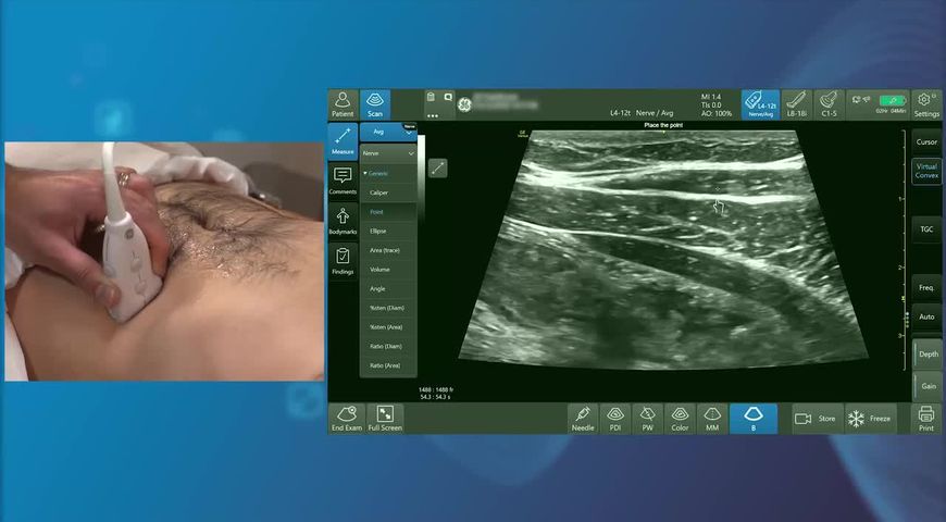 Rectus Sheath Block  with Dr Amit Pawa