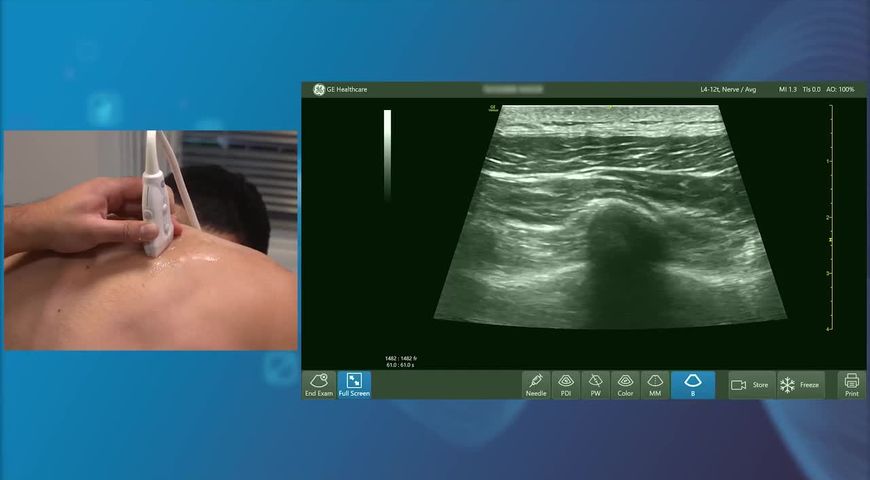 Erector Spinae Block with Dr Amit Pawa