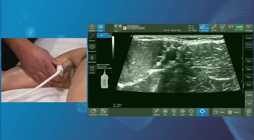 Axillary Block with Dr. Amit Pawa