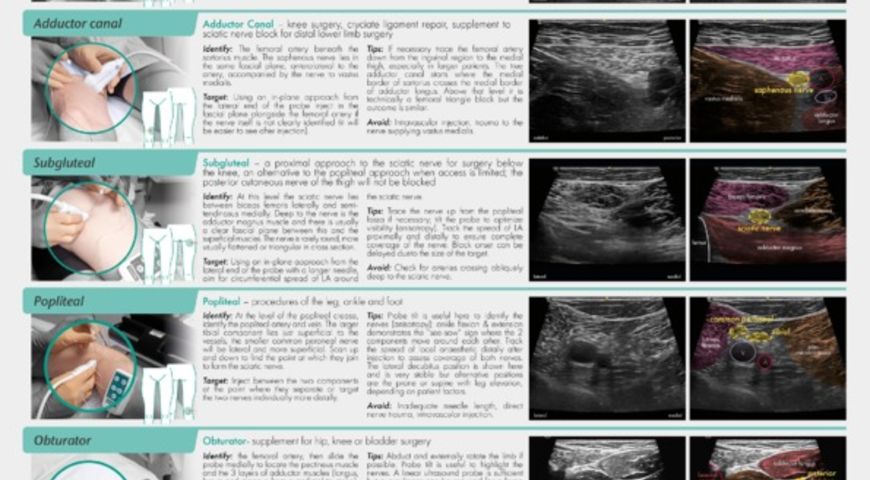Regional Anaesthesia For Lower Limb