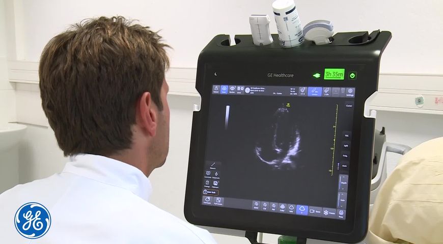 Echocardiography: How to Evaluate the Filling Pressures of the Left Ventricle