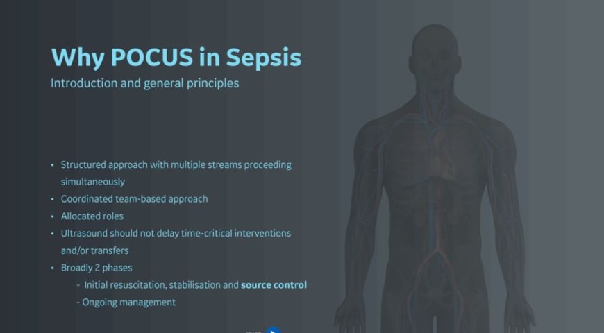 Why Pocus in Sepsis