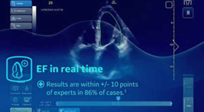 Why Use Real-Time EF in Critical Moments