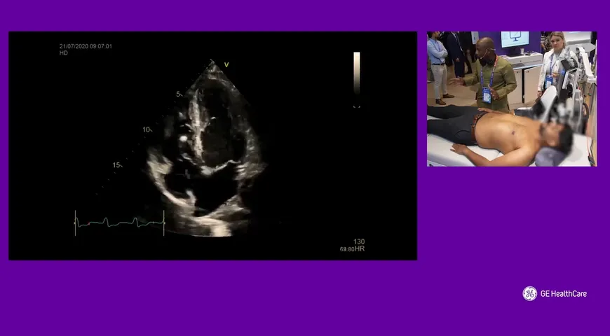 Empowering Critical Care with Ultrasound: A Hands-On Demonstration by Dr Olusegun Olusanya