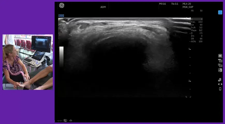 Assessing the ankle for football injuries with Professor Anja Hirshmuller
